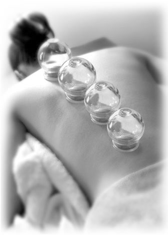 Cupping Therapy